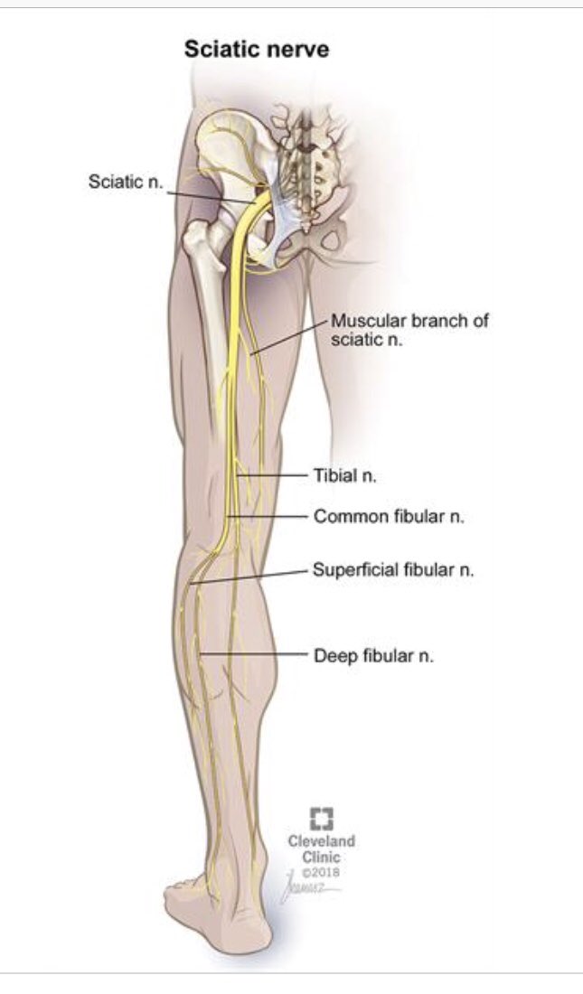 Evacicco's tweet photo. Pt w/ 10+ yr hx of radicular LBP asks why DF causes her pain during SLR. Pt educated on path of sciatic nerve and now understands how her back and leg pain are related. Educating pts on anatomy is an important part of tx and makes the pt a more active participant in their care! https://t.co/LbHfjjhQil