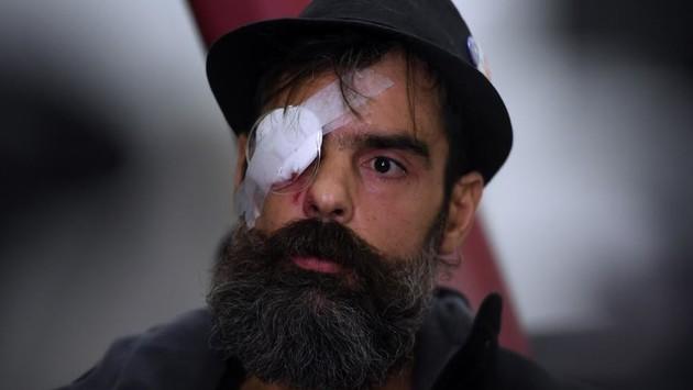 "Gilets jaunes" : nouveau rebondissement dans l'affaire Rodrigues portail.free.fr/actualites/fai…