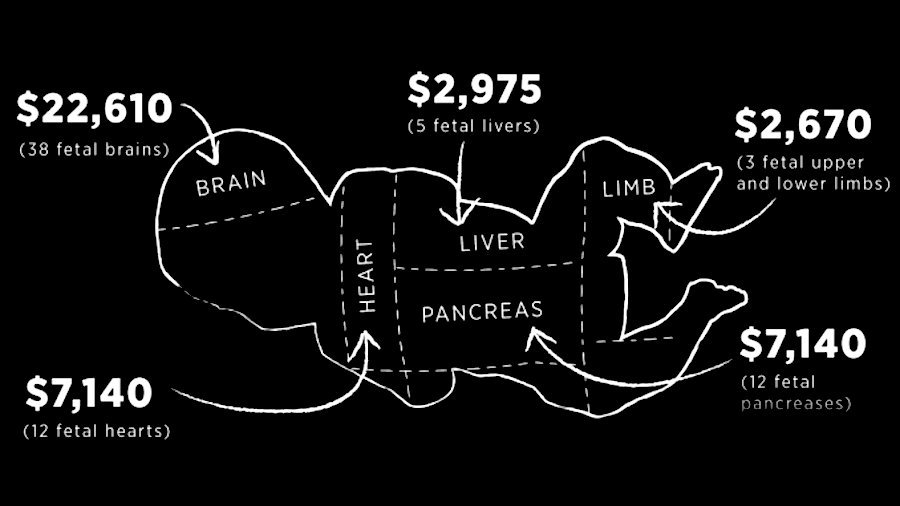 The Criminal Cartels In South America, Latin America, And Mexico Are Pipelines For Sale Of Body Parts. 'Reproductive Health Act' Could Add Up To 300,000 Babies To "Pick" From. https://www.dcclothesline.com/2019/01/29/new-yorks-gruesome-to-term-abortion-bill-will-now-allow-actual-baby-parts-to-be-sold-on-black-market #QAnon  #AbortionLaw  @potus