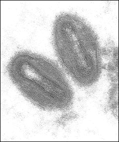 ligero999's tweet photo. #HilosMicrobiología. Hoy os hablaré de un virus que no es muy conocido, se puede decir que es un virus emergente y están aumentando los casos de tal manera que es posible que en un futuro se plantee la posibilidad de volver a introducir la vacuna de la viruela. Su foto es esta: https://t.co/C4iqMJfDW5