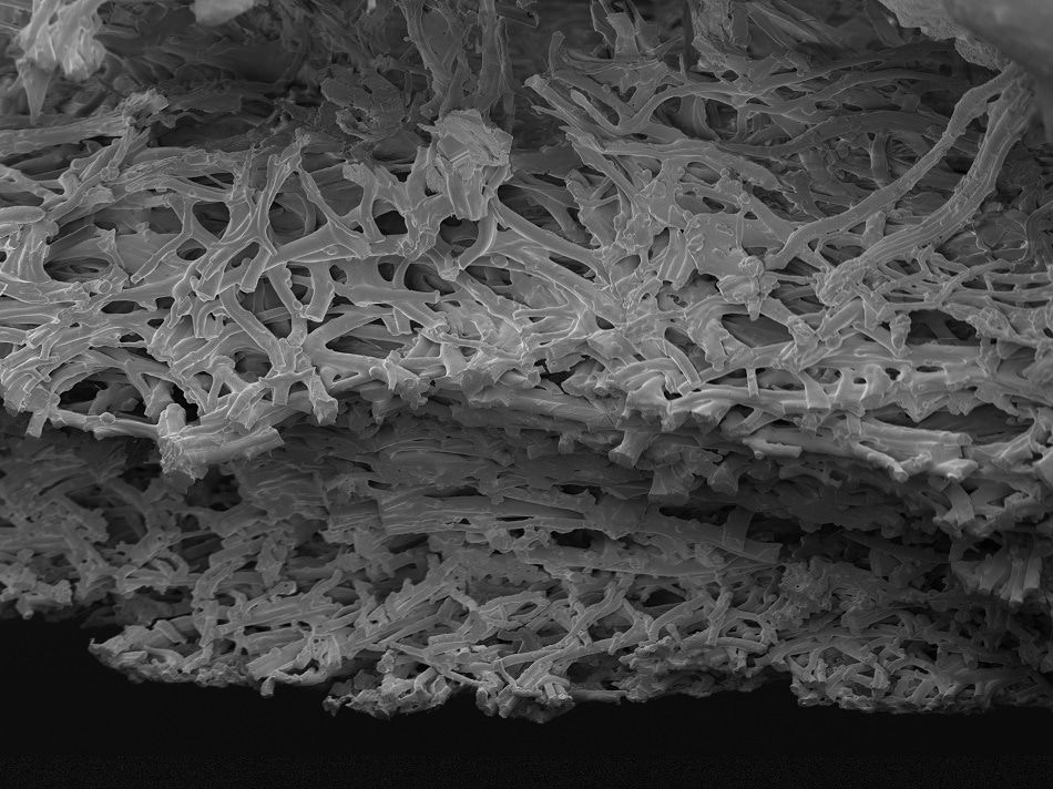 AZoNano's tweet image. A Guide to #AtomicForceMicroscopy #AFM And #TransmissionElectronMicroscopy #TEM
buff.ly/2sp6k97