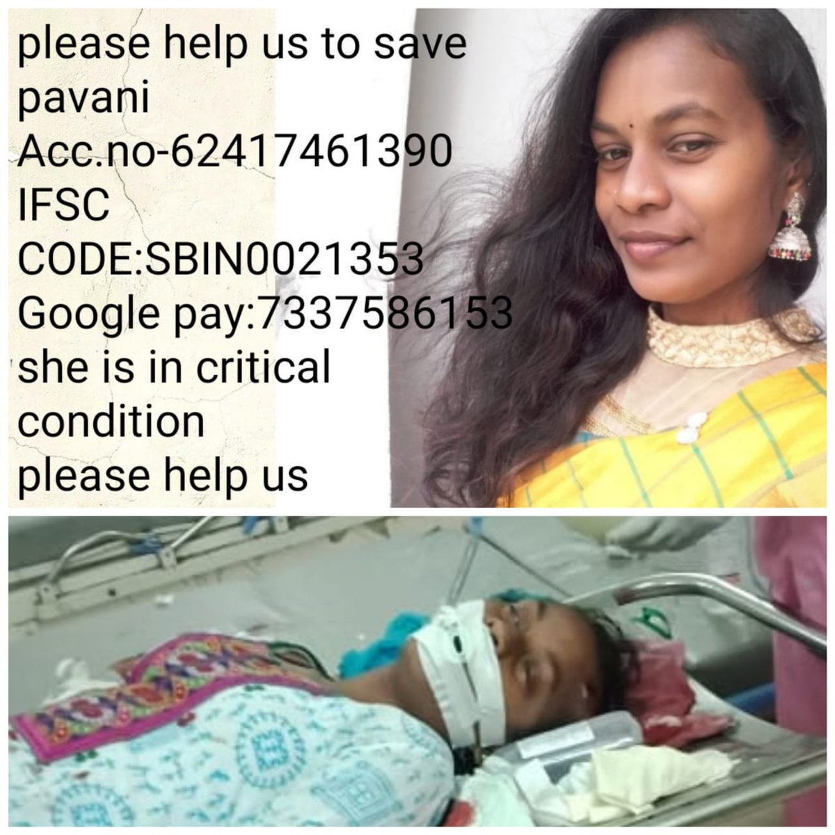 IsmailSfi's tweet photo. @iHrithik @aliaa08 @Actor_Surya_FC @anilambani  sir /ma'am please do help her she met with accident it's real  she is from poor family so we students of SR Engineering  help to raise funds for operation https://t.co/FodPgxOsoC