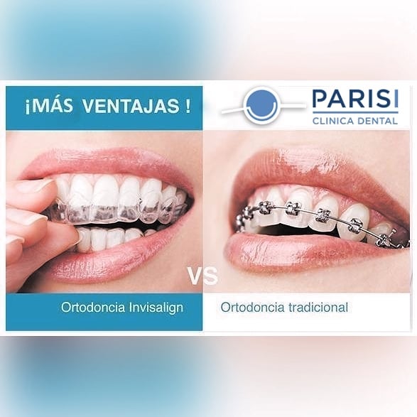 Los ortodoncistas advierten de los riesgos de las férulas de descarga  compradas en farmacias