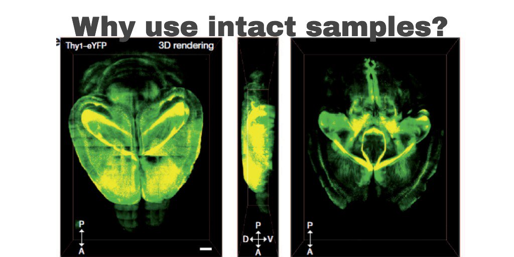 LifeCanvasTech's tweet photo. Why use intact samples for your research? 
Find out the key advantages of using whole-sample methods over thin tissue sections (< 1mm) in this blog post by Dr. Luke Bogart. 
#neuroscience #wholeorgan #3Dimageanalysis #claritytissue #betterscience
https://t.co/OTtAM11ygS https://t.co/IH0tWPmwPG