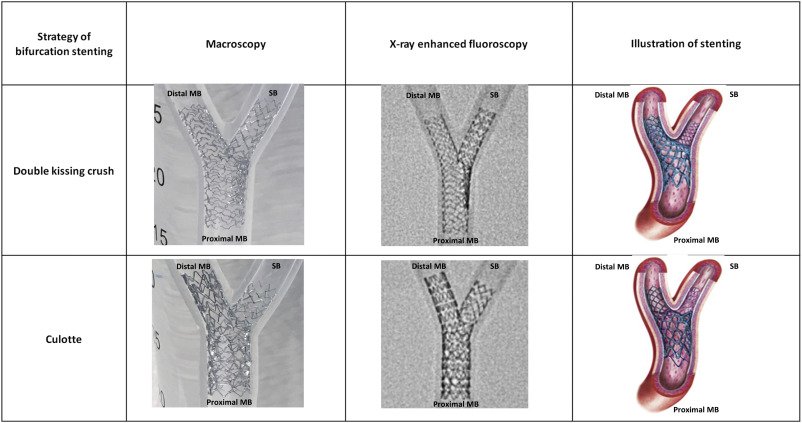 CRMjournal (@CRMjournal) on Twitter photo 2019-02-06 22:08:00 Article in press: Feasibility of a #porcine #arteriovenous #shunt model for assessment of acute #thrombogenicity in #bifurcationstenting technique by #OCT by Kazuhiro Dan, @hect2701, @ESHLOF, ... @HellingaDavid, @fkolodgie, @AHKajita, ... @ron_waksman bit.ly/2MKV1kR Article in press: Feasibility of a #porcine #arteriovenous #shunt model for assessment of acute #thrombogenicity in #bifurcationstenting technique by #OCT by Kazuhiro Dan, @hect2701, @ESHLOF, ... @HellingaDavid, @fkolodgie, @AHKajita, ... @ron_waksman bit.ly/2MKV1kR