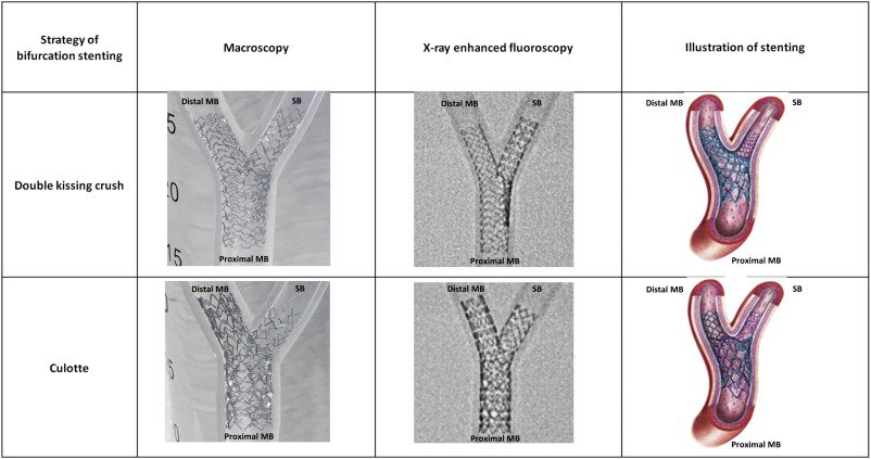 Article in press: Feasibility of a #porcine #arteriovenous #shunt model for assessment of acute #thrombogenicity in #bifurcationstenting technique by #OCT by Kazuhiro Dan, @hect2701, @ESHLOF, ... @HellingaDavid, @fkolodgie, @AHKajita, ... @ron_waksman bit.ly/2MKV1kR