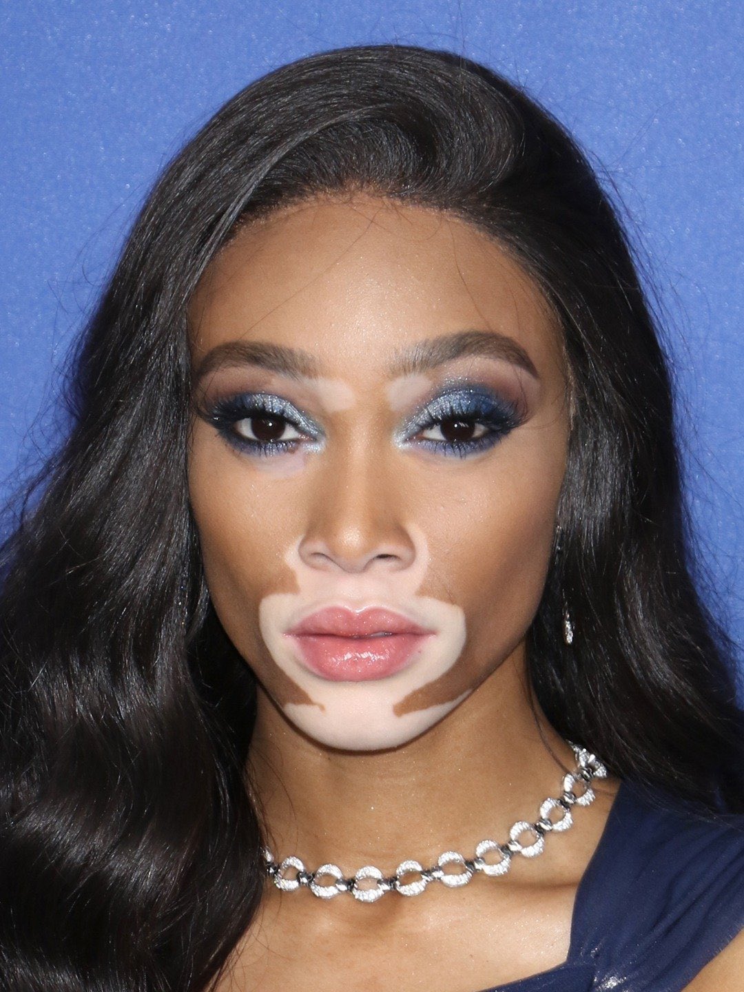 How to Wear Makeup With Vitiligo According to Influencer Lauren