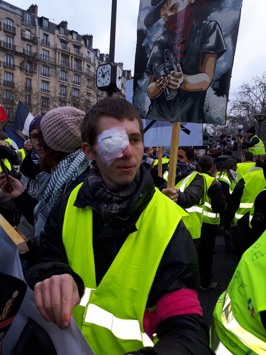 BrunoPaumard's tweet photo. Pour Franck, 20 ans dont la vie est bousillée ‼️😡🇫🇷💛 #GiletsJaunes #Acte12 https://t.co/MP3oClVmR2