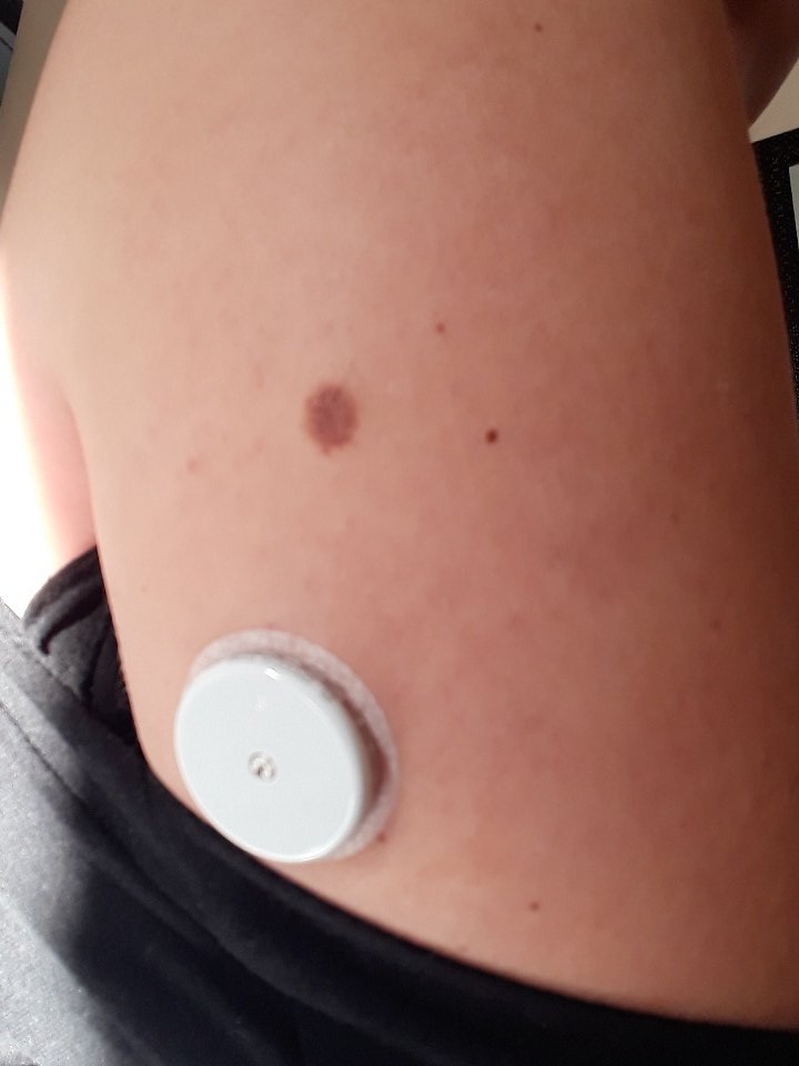 Twitter এ Medtrumdiabeteseurope Chloebean Yes You Beat Me There Enjoy Your Libre ট ইট র