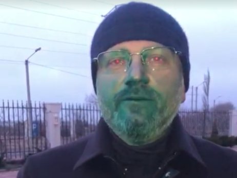 США уважно стежать за ситуацією зі звільненням Супрун, - посольство - Цензор.НЕТ 74