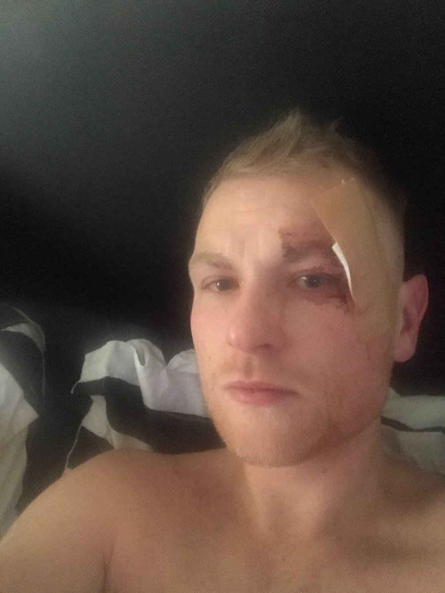 keeganrees's tweet photo. Hi did anyone see my friend @Liam_murph123 get dropped in hobos last night any info contact @TomosLoosemore #helpliam #victim https://t.co/GwC3Qa1KiX