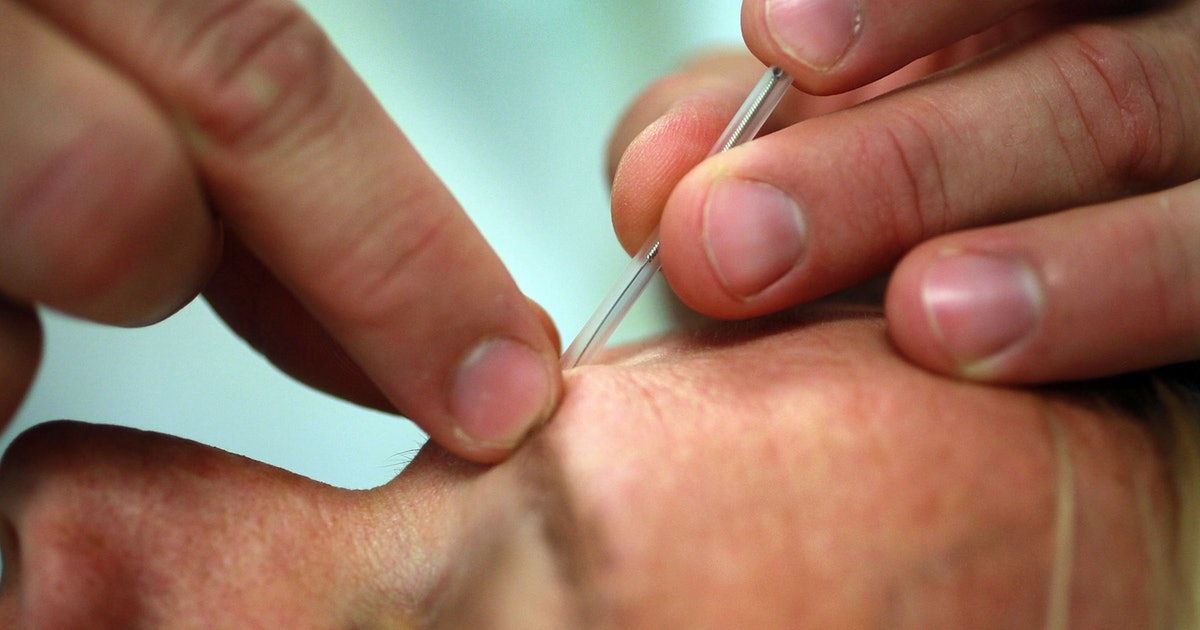 '7 Ways #Acupuncture Changes Your Brain, According To Science', from <a href="/bustle/">Bustle</a> 
buff.ly/2MT4zdI