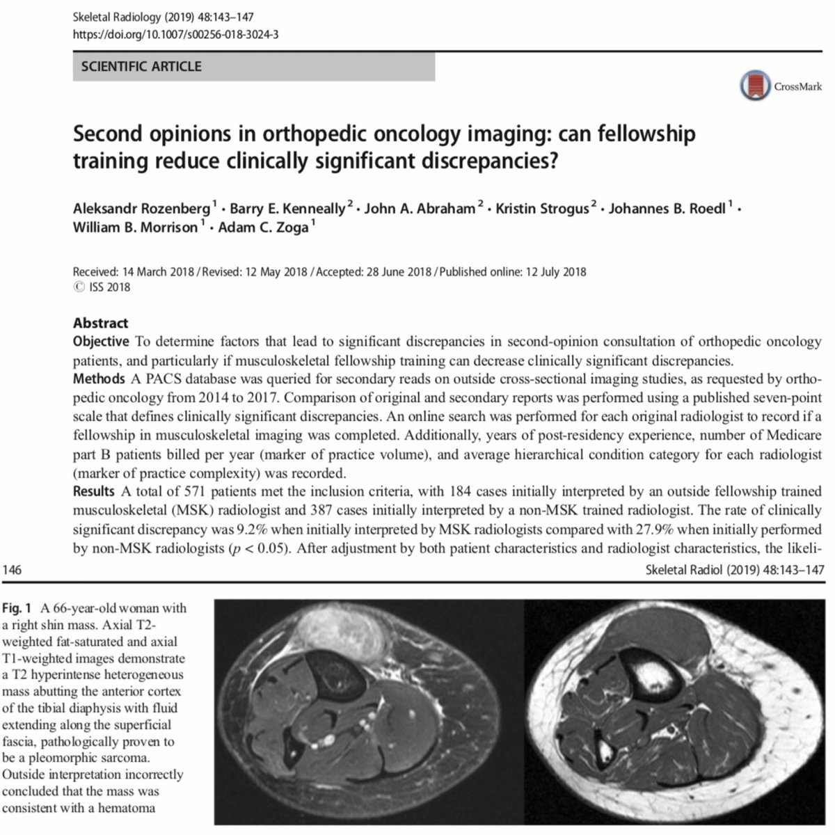 SkeletalRadiol's tweet photo. Second opinions in orthopedic oncology imaging: can fellowship training reduce clinically significant discrepancies by Rozenberg et al.

https://t.co/uTKZqsHPkC https://t.co/t9gxE9VcNA
