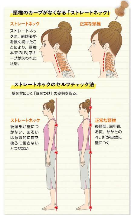 O Xrhsths 斗真のフリするジーノちゃん Sto Twitter 首と頭の付け根の関係だけ考えると右に近いけど 後頭部と背中が同じラインにある訳じゃない とすると 胸郭のアーチがより強くて 胸椎と頚椎の切り替えポジションはより前にある可能性が高いよね Https T