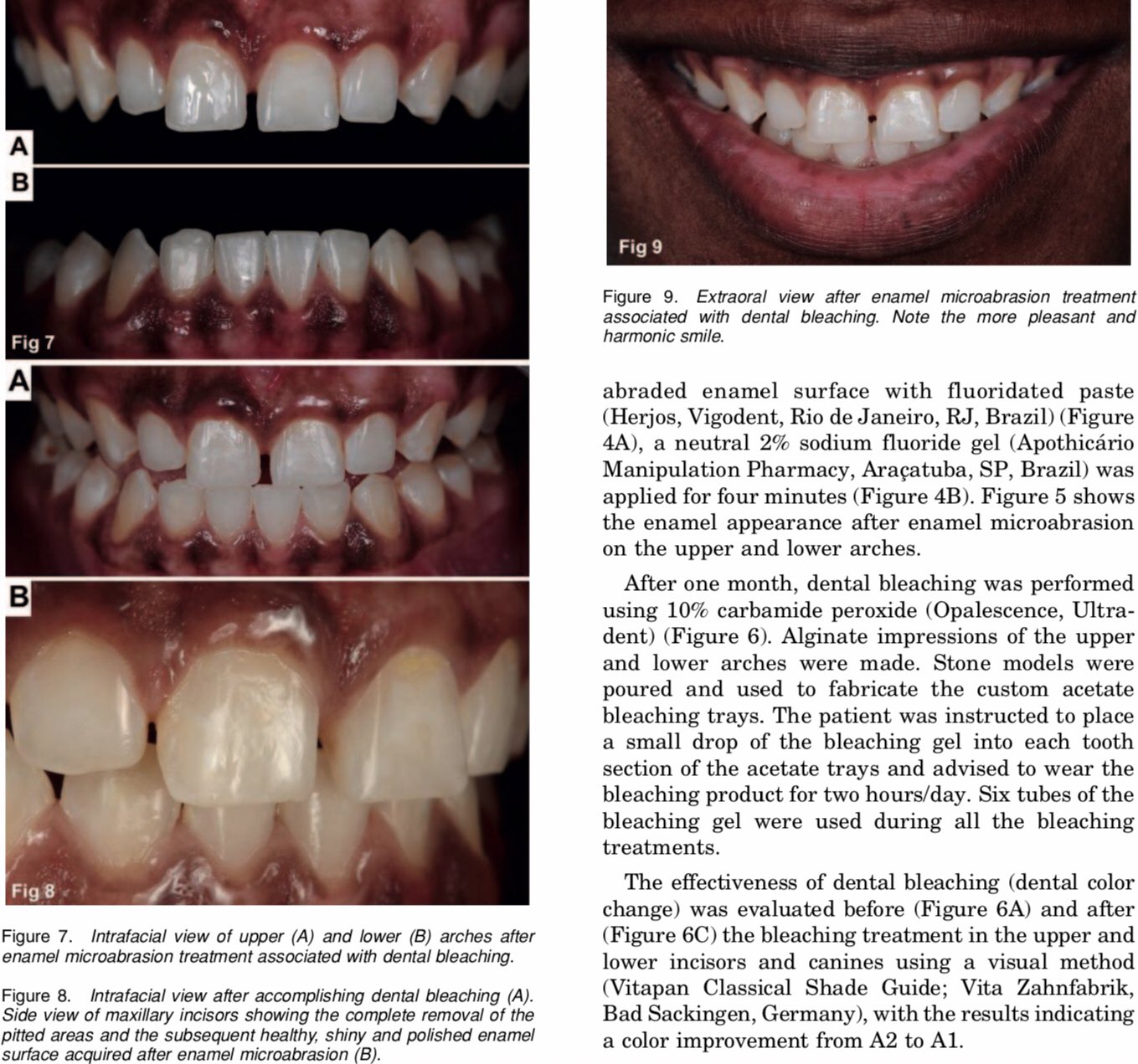 Dr.Bandar on Twitter "The present case report described enamel