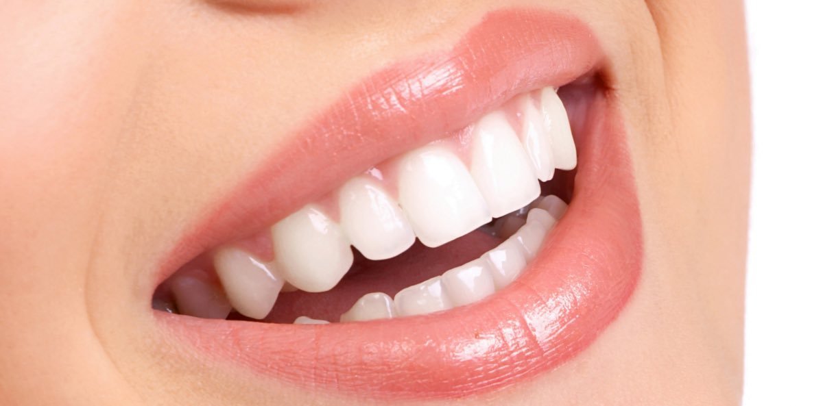 Lucir una sonrisa bonita y saludable nos ayuda a mejorar nuestra calidad de vida. En Dental Galbis tenemos un 15% de descuento este mes para tu tratamiento de #ortodoncia Ven y pide presupuesto sin compromiso. Estamos en Plaza Juan Malasaña, 8  Villa de Vallecas. Madrid.913321515