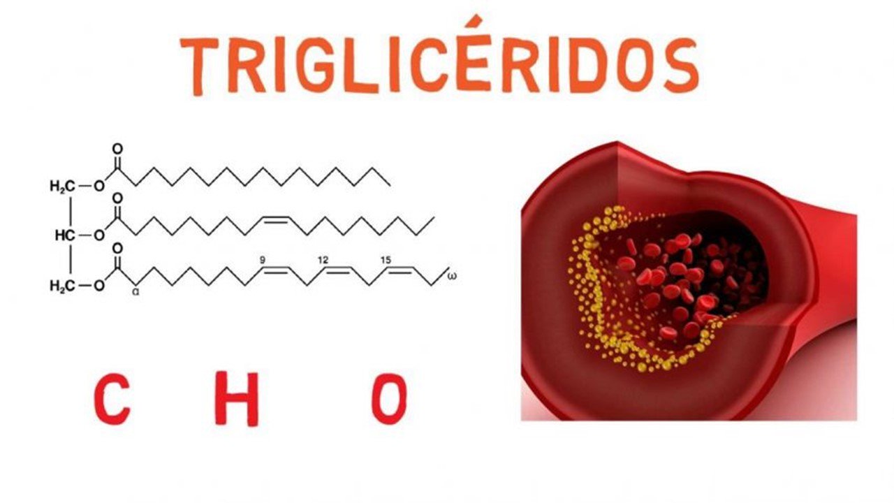 Niveles correctos de trigliceridos