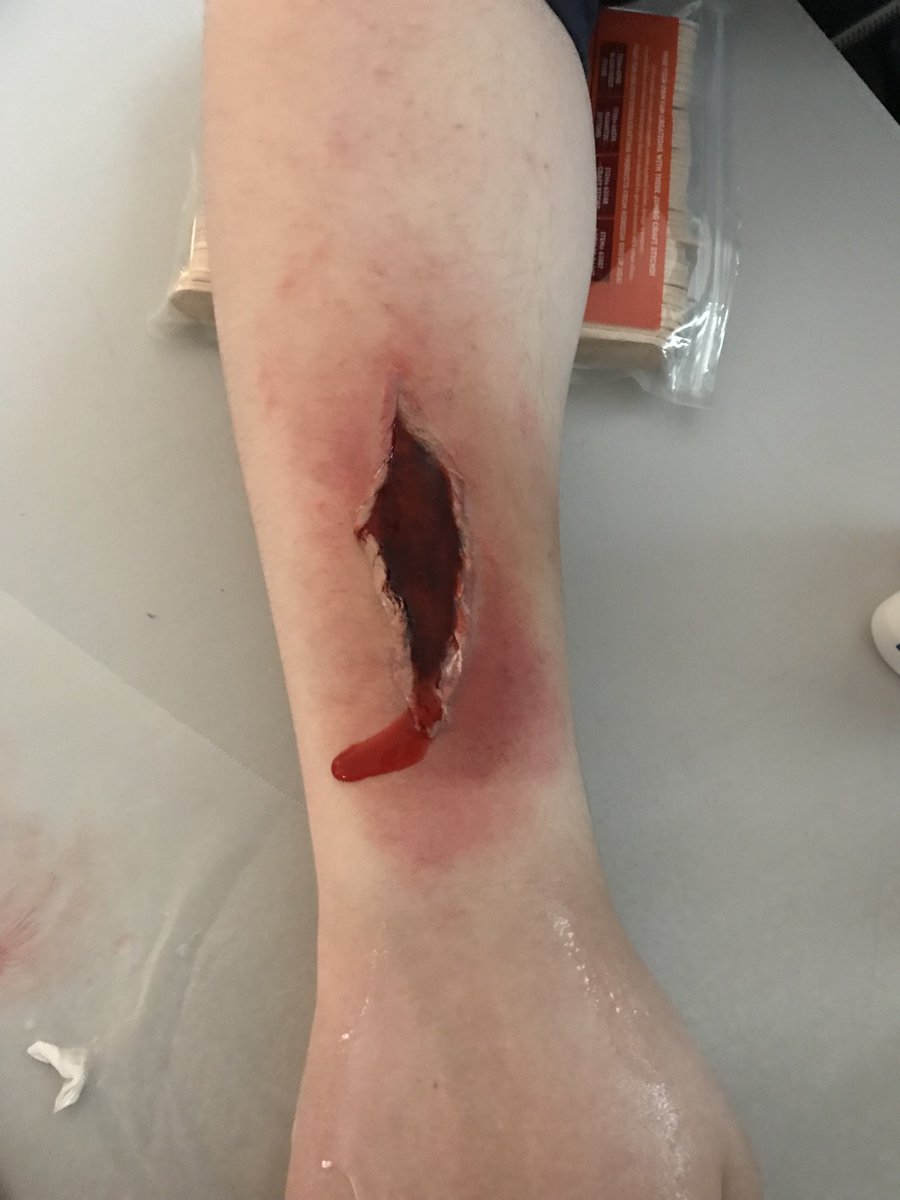 FirstOnScene2's tweet image. #firstonscene #FirstAid #Training #Medical #Firefighters