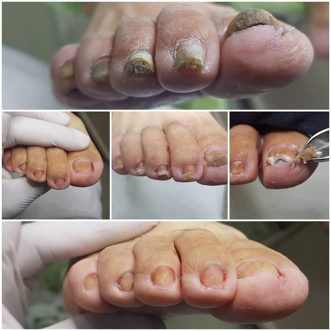 fepoal's tweet photo. El podólogo es profesional de la salud que se encarga del cuidado de los pies. ¡No dejes tus pies es manos inexpertas!
#PodologíaDeVerdad
#FEPOALenMOVIMIENTO https://t.co/t8DH3MfgVs