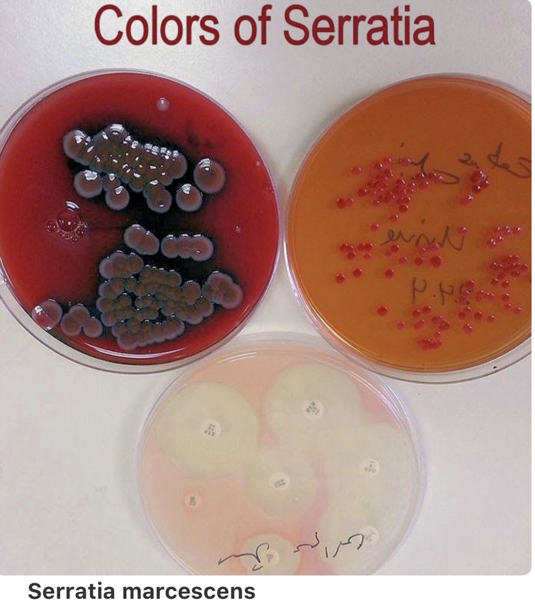 Feeda2017's tweet photo. Microbiology and Hematology🔬🦠 https://t.co/skY7X1VkJe