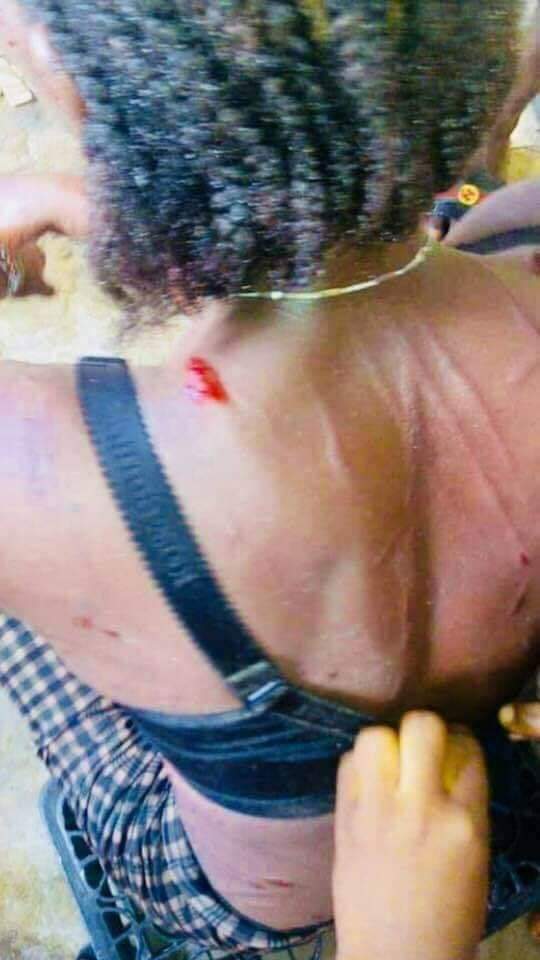 viclinlove's tweet photo. Her husband did this to her because she was caught having sex with a neighbor.

Twitter lawyer &amp; judges I have brought this to the court for y'all to judge this case, was the husband right or wrong? https://t.co/84dQtqk2CI