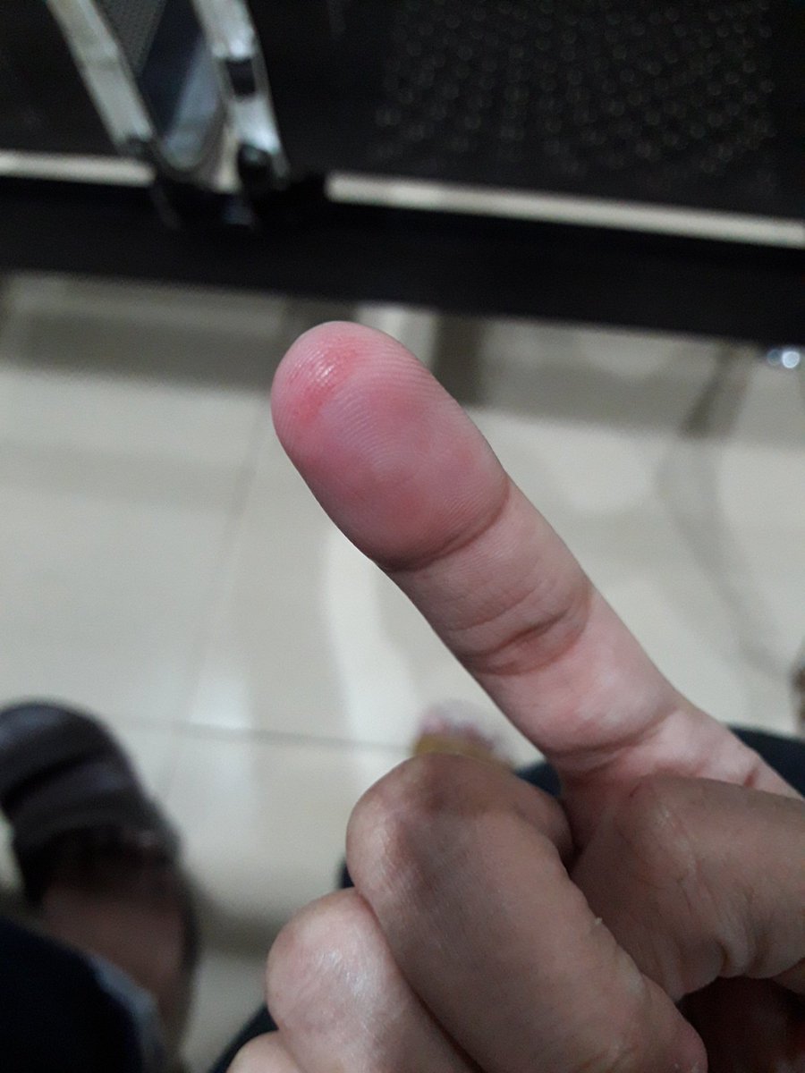 aoisyevi's tweet photo. Peristiwa hari ini...😐 https://t.co/kTC5MjMybj