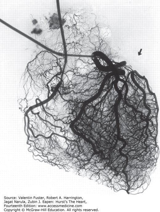 Mark Mills tweet media