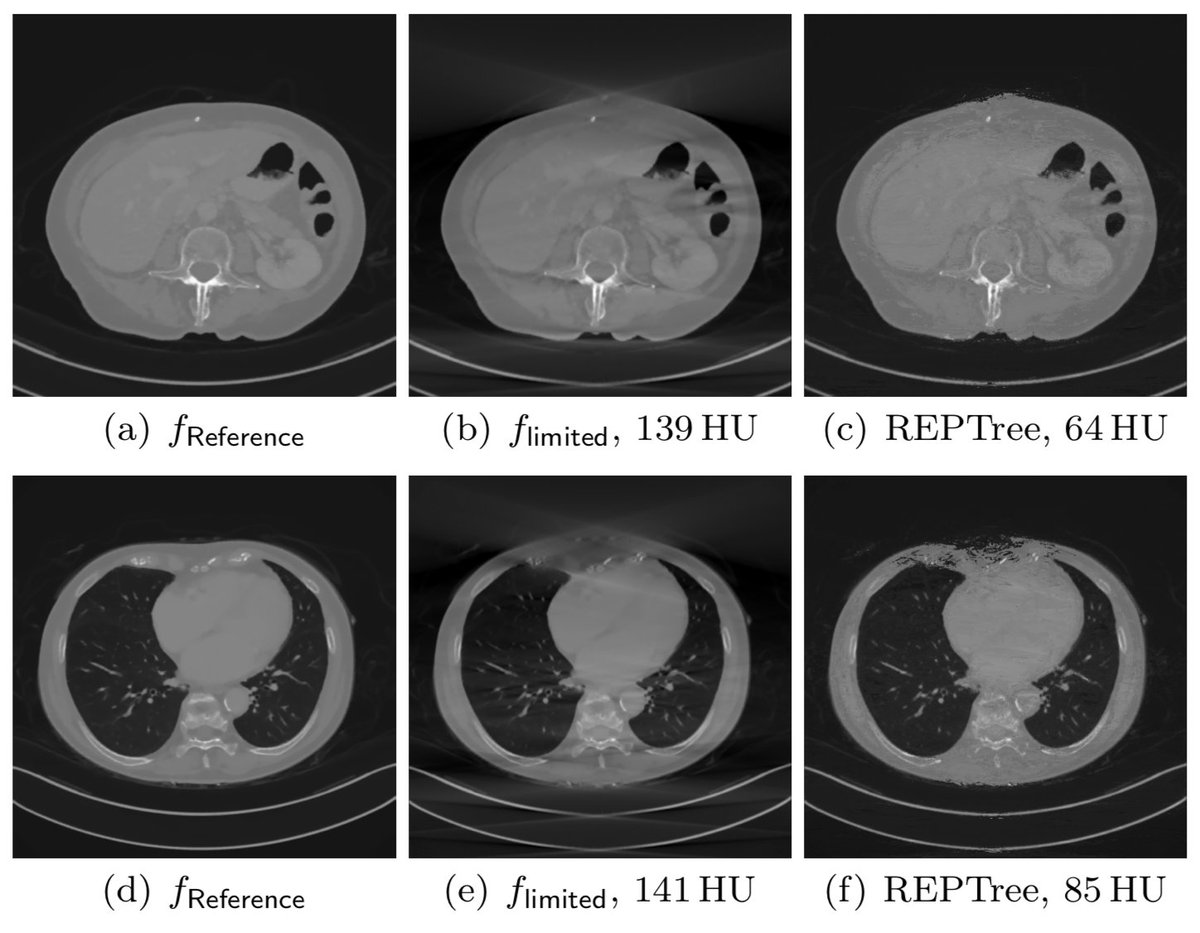 maier_ak's tweet photo. Also classical #machinelearning methods perform quite well to complete #medicalimages:
https://t.co/qBTT8gkiup
Great work by @YixingHuang1!
#nodeeplearning @BVM_Community @FAU_Germany #deeplearning #reconstruction https://t.co/vRcCuARvP3