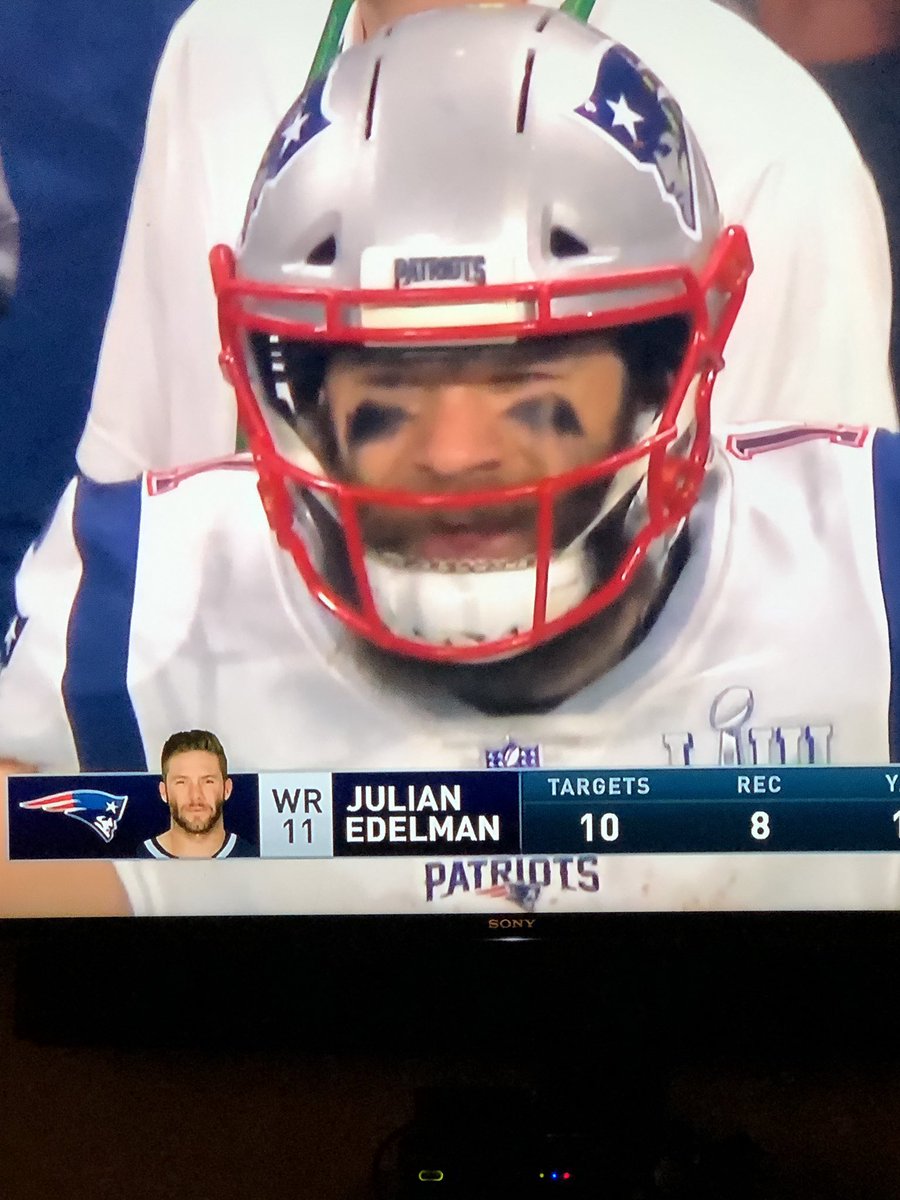 tomsegura's tweet photo. You can see Edelman's brain damage in every close up. https://t.co/dgxijwRsN5
