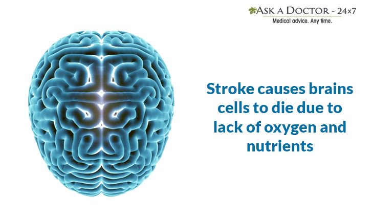DailyHealthTips's tweet image. Largest Health Q&amp;amp;A site.
Ask a Doctor Online at
askadoctor24x7.com/app

#stroke #lackofoxygen # #lackofcoordination #AskADoctor #DailyHealthTips #HealthcareMagic