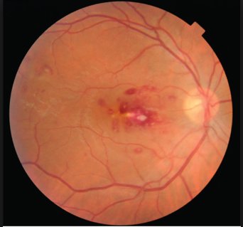 VirologyRes's tweet photo. #Viral #Infections of the Posterior Segment of #Eye: What is the Role of the #EpsteinBarrVirus?
https://t.co/DECd3jq7Pa
Invitation For Submission: Virology Reearch Journal
Submit your Manuscript at: editor.virology@immunologyjournals.com (or) direct contact via twitter https://t.co/gKLSzhrrYE