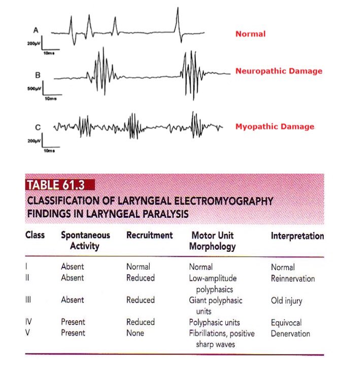 Laryngeal EMG: