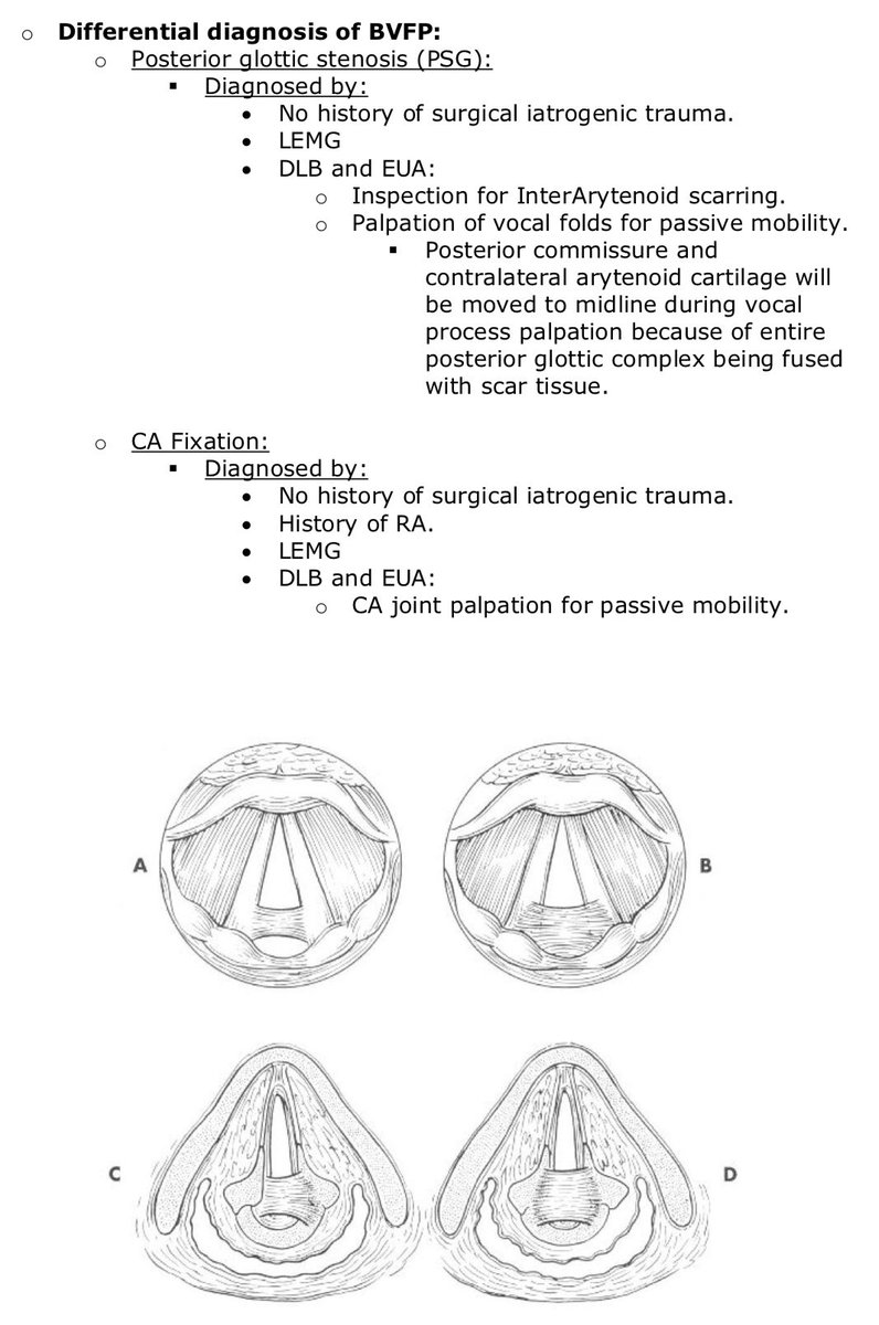 DDx of bilateral VCP:
