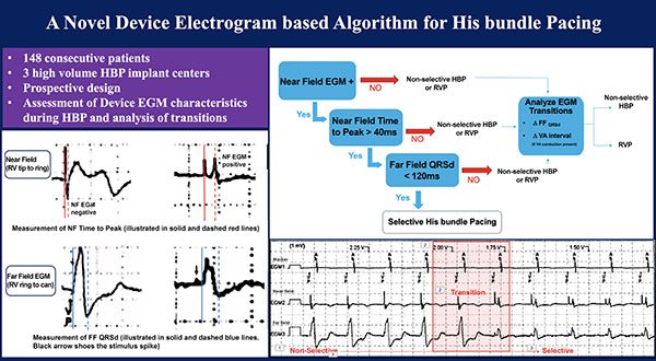A new device-based algorithm that uses near-field and far-field EGMs may help identify morphology of HBP and make follow-up safe and efficient. #dontdisthehis ow.ly/rcxj30nzExQ