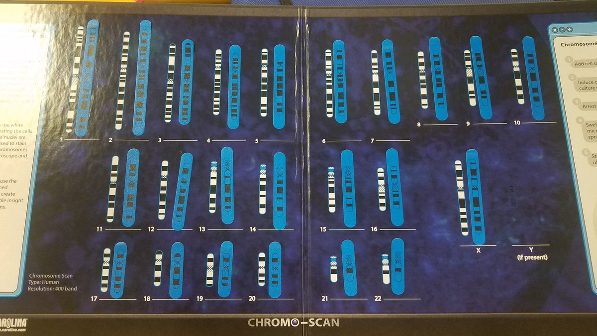 aud_bio's tweet photo. Case Study D: my patient has a chromosomal abnormality in chromosome 5 causing cri-du-chat syndrome. https://t.co/xqdbBftf6l