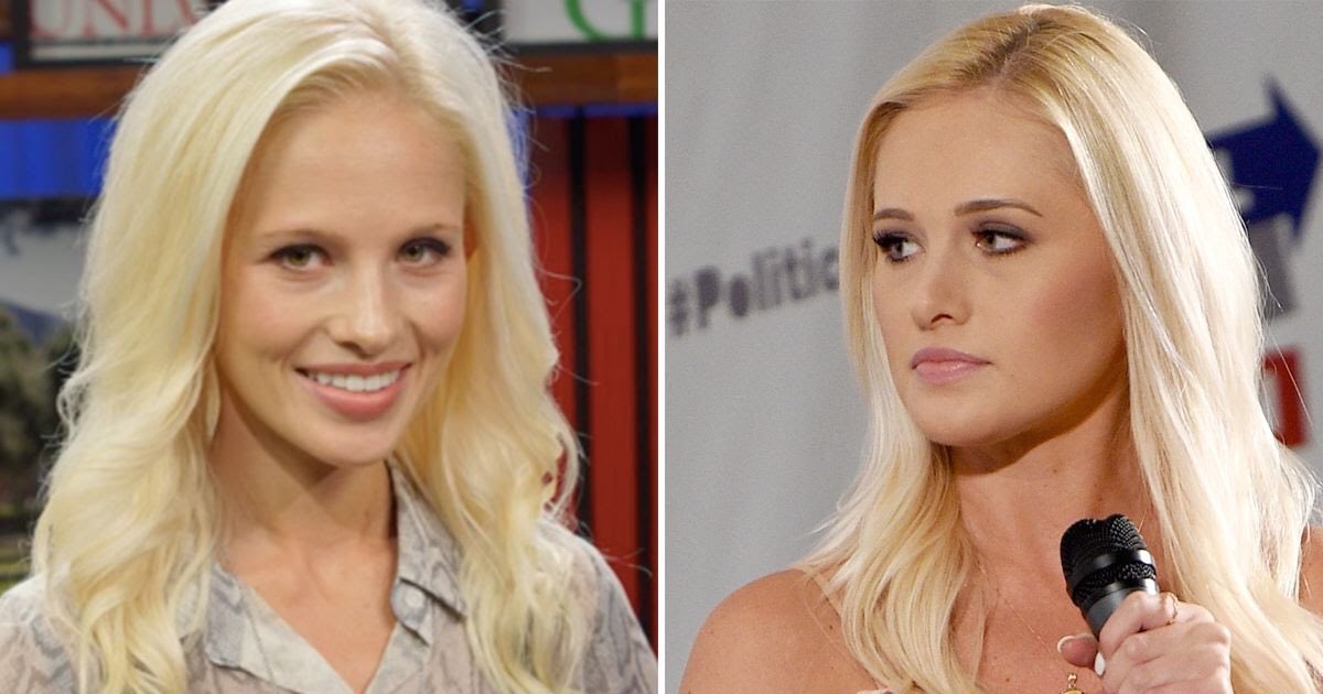 Didn’t know Tomi Lahren had plastic surgerypic.twitter.com/RtqDX29avg.