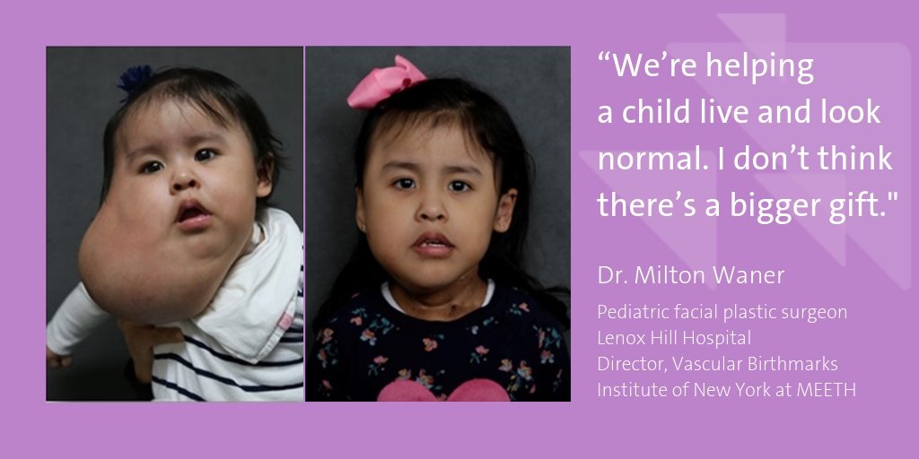 lenoxhill's tweet photo. 98% of the softball-sized growth that engulfed little Sandy's face/neck is now gone, thanks to her surgeons, Dr. Milton Waner &amp; Dr. Teresa O (@VBirthmarks). @ABC7NY's @LaurenGlassberg shows how they gave the now preschooler a chance at a normal life - https://t.co/DJpYWj0wMM https://t.co/vPWrsNKOyi