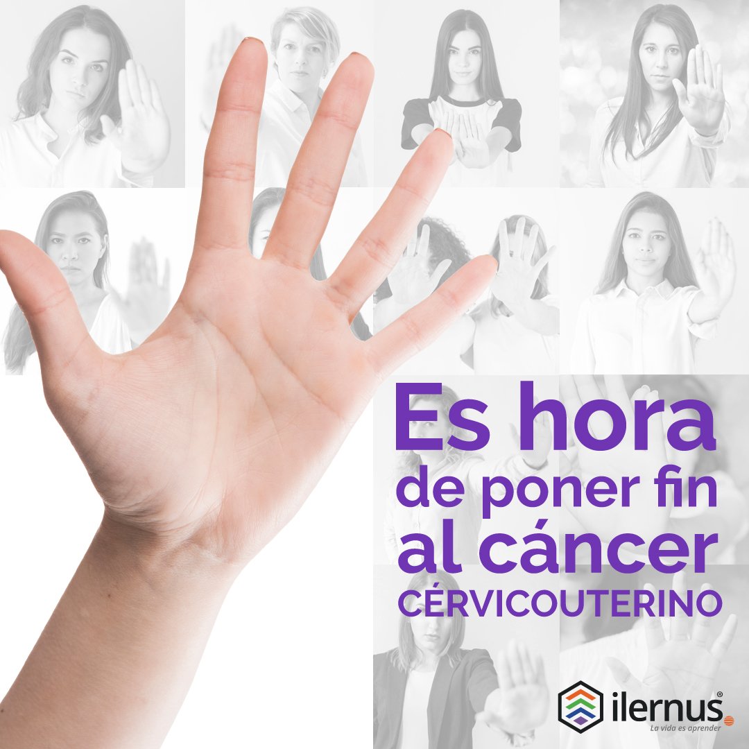 Ilernus's tweet photo. Cada 4 de febrero alzamos la voz y le decimos a todos aquellos pacientes que padecen la enfermedad, que no están solos.
Este año la campaña va dirigida a conscientizar sobre el cáncer cervicouterino, que ocupa el 2do lugar por causa de fallecimiento cancerígeno en América Latina. https://t.co/IGpLhsgUxO