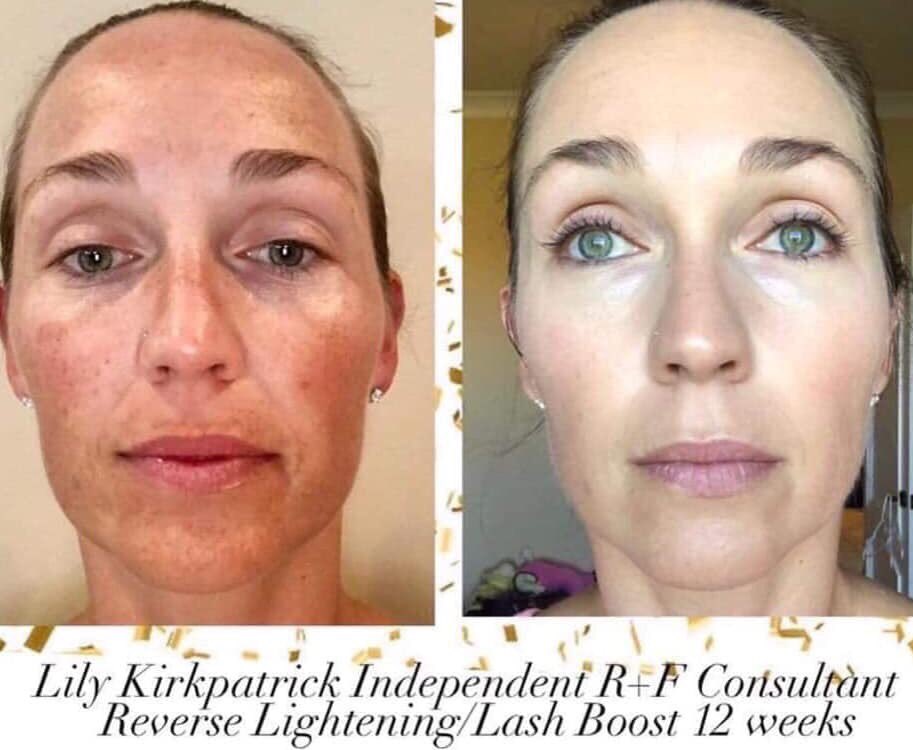 flawlesszkin's tweet photo. Just look at her results 🤯 https://t.co/opwX7vQXri