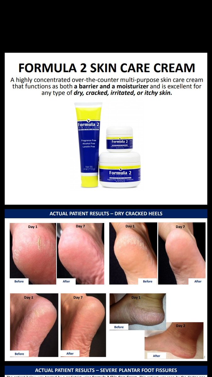 Formula2Cream's tweet photo. @KevinHart4real https://t.co/G9gUCpmniz