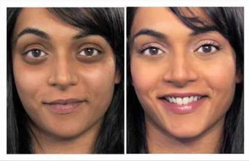 SculptIndia's tweet photo. Are you really tired with your #darkcircles and #depthbeloweyes . Book your appointment with us @sculptclinic in delhi .

For more information click; https://t.co/Je2PobQDP8

#bestclinicforskintreatmentdelhi https://t.co/zr1mjKPf1R