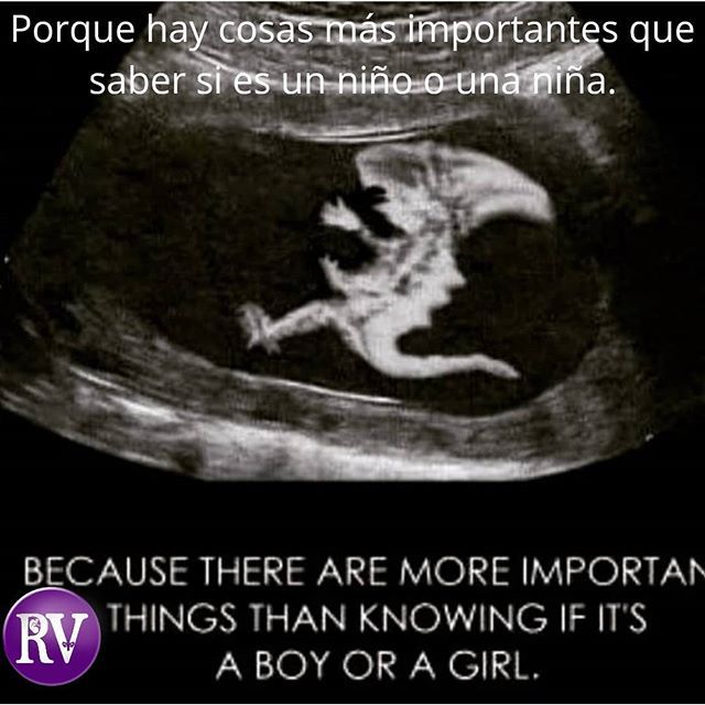 doctorarosalba's tweet photo. Cuando acudas a tu consulta obstétrica no te enfoques solo en saber el sexo de tu bebé, pregunta por los estudios especiales como eco morfológico, ecografía 4D y doppler fetal, así como los maracdores genéticos de cromosomopatia.
Por un mejor futuro para tu familia 👪.
#obste… https://t.co/yudkb7SpNC
