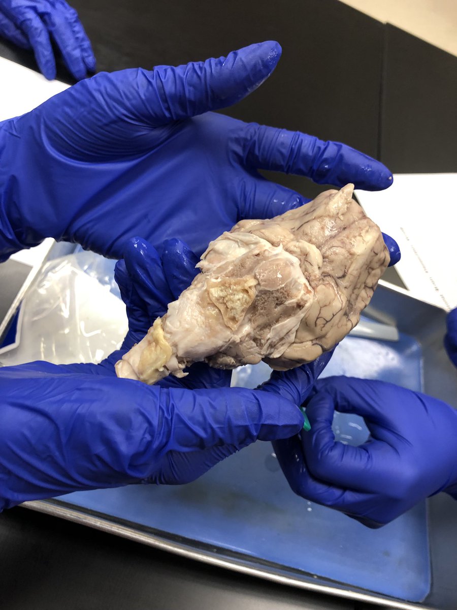 ftprenursing's tweet photo. Anatomy students wrapped up the nervous system unit with the much anticipated sheep brain dissection! https://t.co/bzYgvl72tw