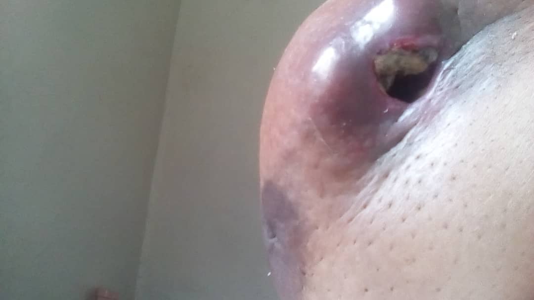 HRVallenilla's tweet photo. Amiga con Ca de mama C/metastasis pulmonar y Columna requiere GASAS POVIDINE CENTROS de CAMA para su higiene pocos recursos ayuda entre todos podemos 04163279468 @fundatiacruz
@FLaPastillita
@SenosAyuda @ESEdeSalud @MamaLisVzla https://t.co/3SneGIPaLA