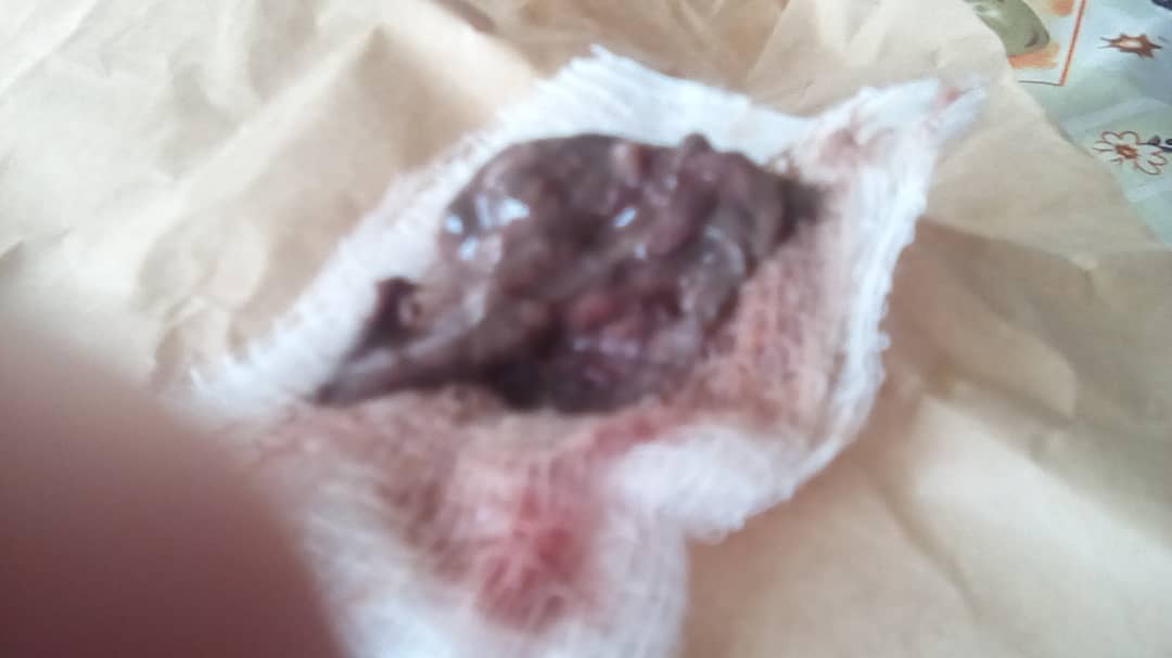 HRVallenilla's tweet photo. Amiga con Ca de mama C/metastasis pulmonar y Columna requiere GASAS POVIDINE CENTROS de CAMA para su higiene pocos recursos ayuda entre todos podemos 04163279468 @fundatiacruz
@FLaPastillita
@SenosAyuda @ESEdeSalud @MamaLisVzla https://t.co/3SneGIPaLA
