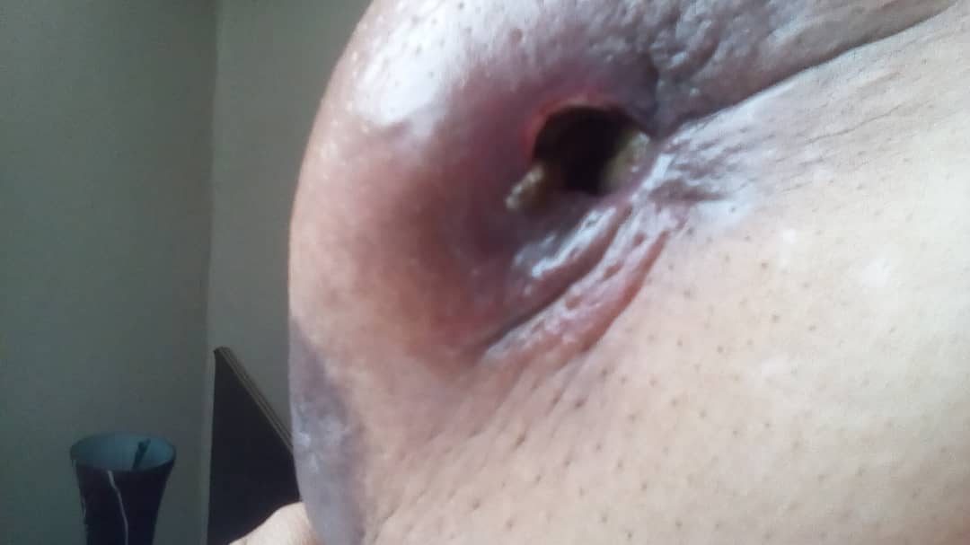 HRVallenilla's tweet photo. Amiga con Ca de mama C/metastasis pulmonar y Columna requiere GASAS POVIDINE CENTROS de CAMA para su higiene pocos recursos ayuda entre todos podemos 04163279468 @fundatiacruz
@FLaPastillita
@SenosAyuda @ESEdeSalud @MamaLisVzla https://t.co/3SneGIPaLA
