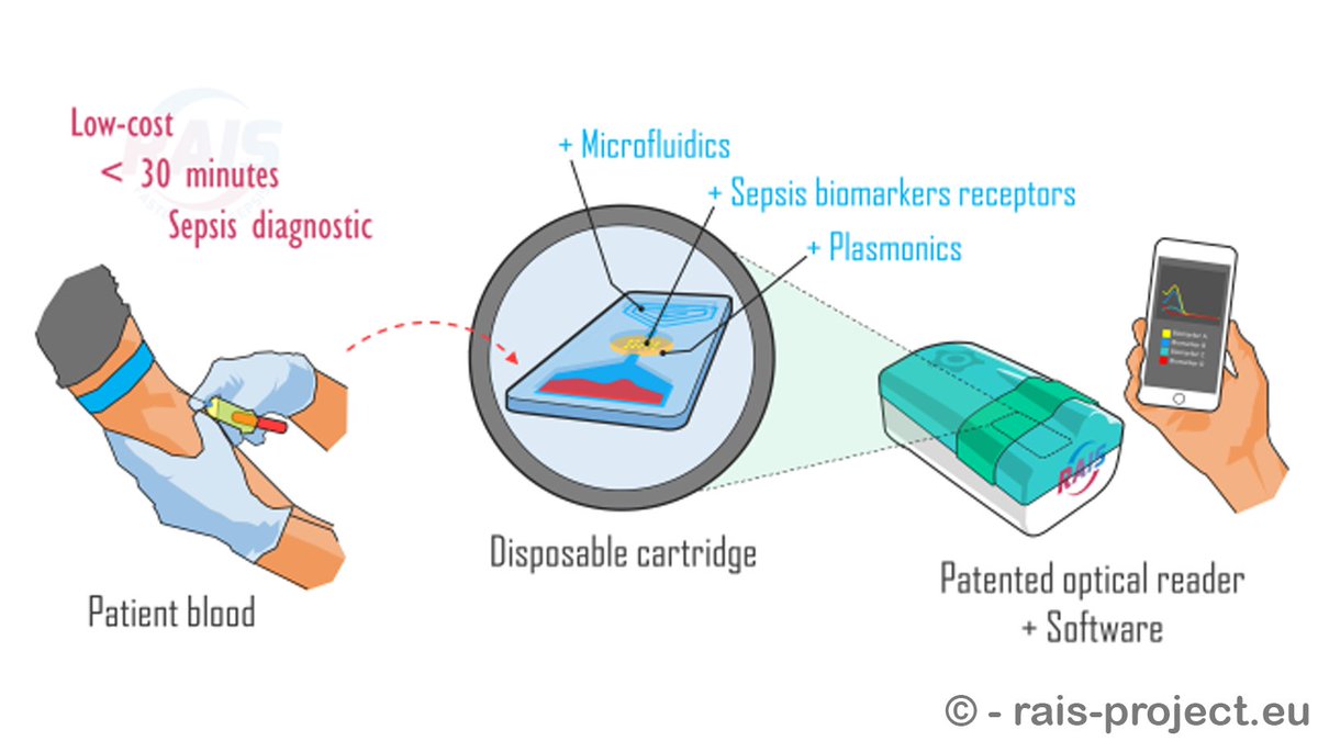CORDIS_EU's tweet image. Portable device developed by #EUfunded @RAIS_Project helps to diagnose #sepsis in less than 30 minutes ⏲️ at a significantly lower cost 💸 #Biomarkers #HealthTech #Microarray
➡️ bit.ly/2AxfmEB