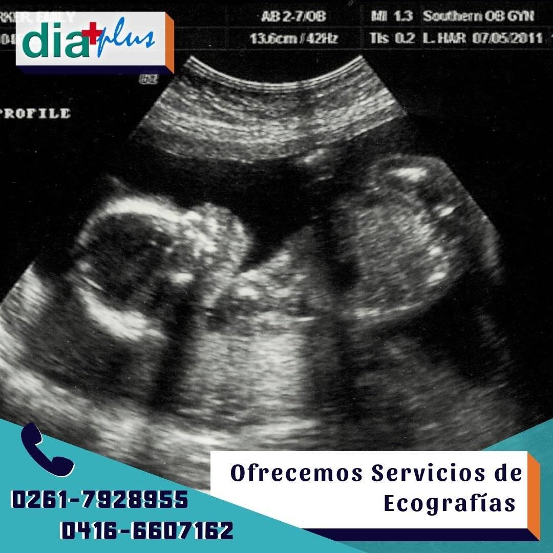 diaplusca's tweet photo. #DiaPlus dispone de ecógrafos digitales con capacidad Doppler a color de última generación y profesionales altamente reconocidos y experimentados en el diagnóstico por imágenes (Ecogramas y Eco-Doppler) para la completa evaluación del paciente . Tlf: 0261-7928955/0416-6607162 https://t.co/g9olnt8xHj