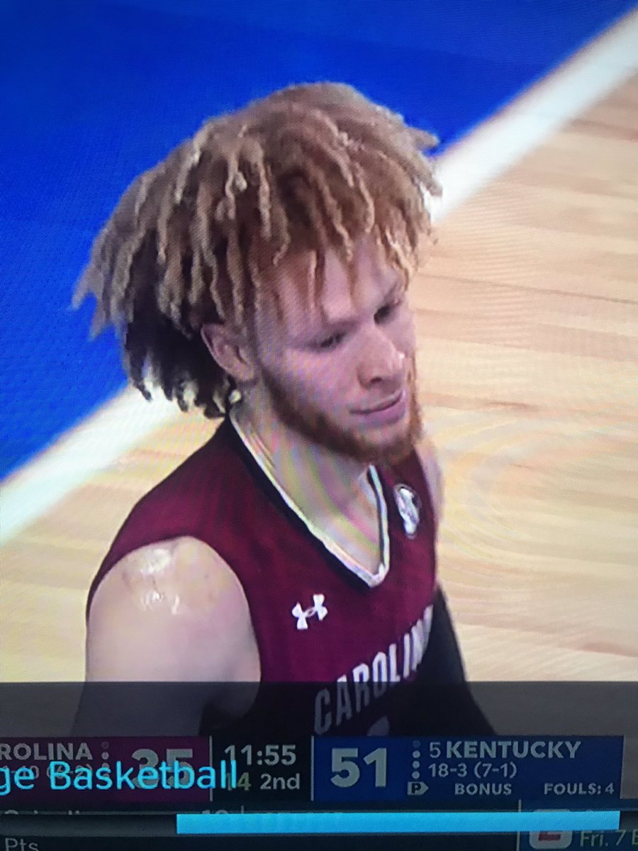 vettemonster's tweet image. Is it just me or does #2 on South Carolina look like sideshow bob?  #bbn