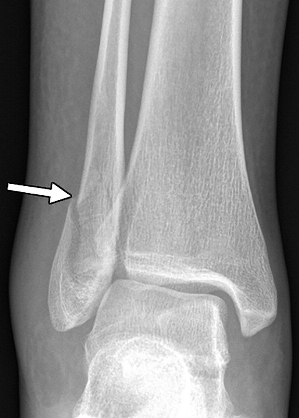 RSNA's tweet photo. According to a study published in @Radiology_rsna, imaging offers clues to identify potential domestic violence-related patterns of injury. Learn more in RSNA News. https://t.co/QAL8QtEGjW #RadMSK #EMRad #PatientCenteredCare https://t.co/OaRJ9p0u4l